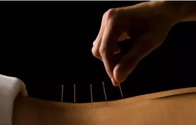 平衡針灸最新視頻，現(xiàn)代應(yīng)用探索針灸藝術(shù)的新境界