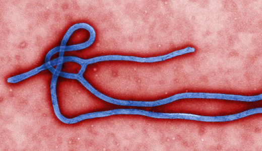 警惕最新病毒病人，你需要了解這些關(guān)鍵信息！