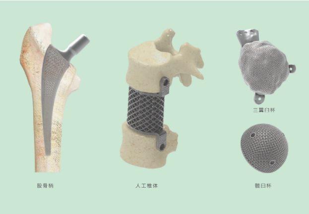 三維打印髖關(guān)節(jié)技術(shù)新動態(tài)，重塑生活的科技魔法奇跡