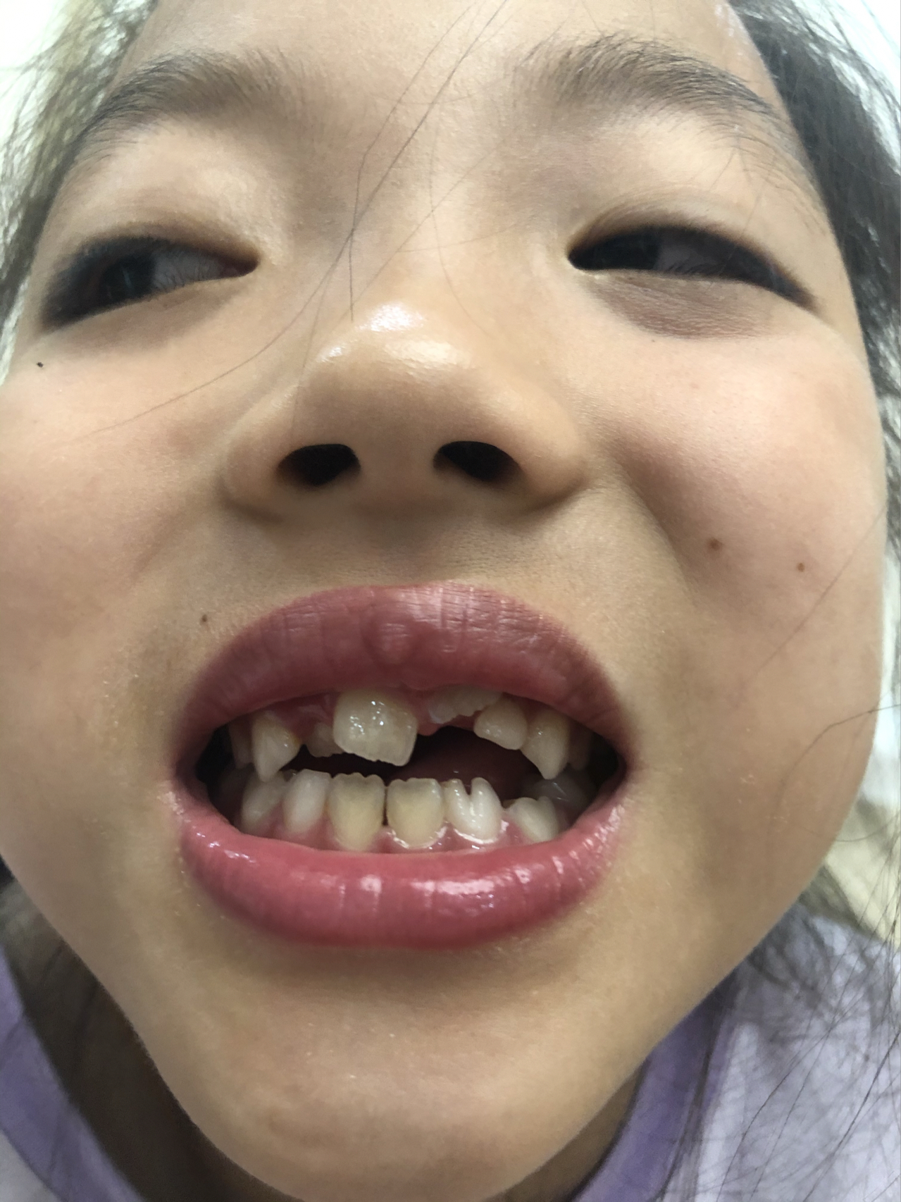 莊最新牙齒技術(shù)揭秘，牙齒美容新選擇